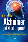 Alzheimer jetzt stoppen! Alzheimer jetzt stoppen!